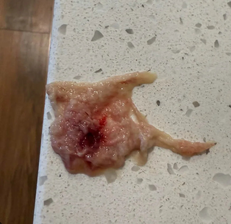 Una flema espesa con rastros de sangre sobre un mesón
